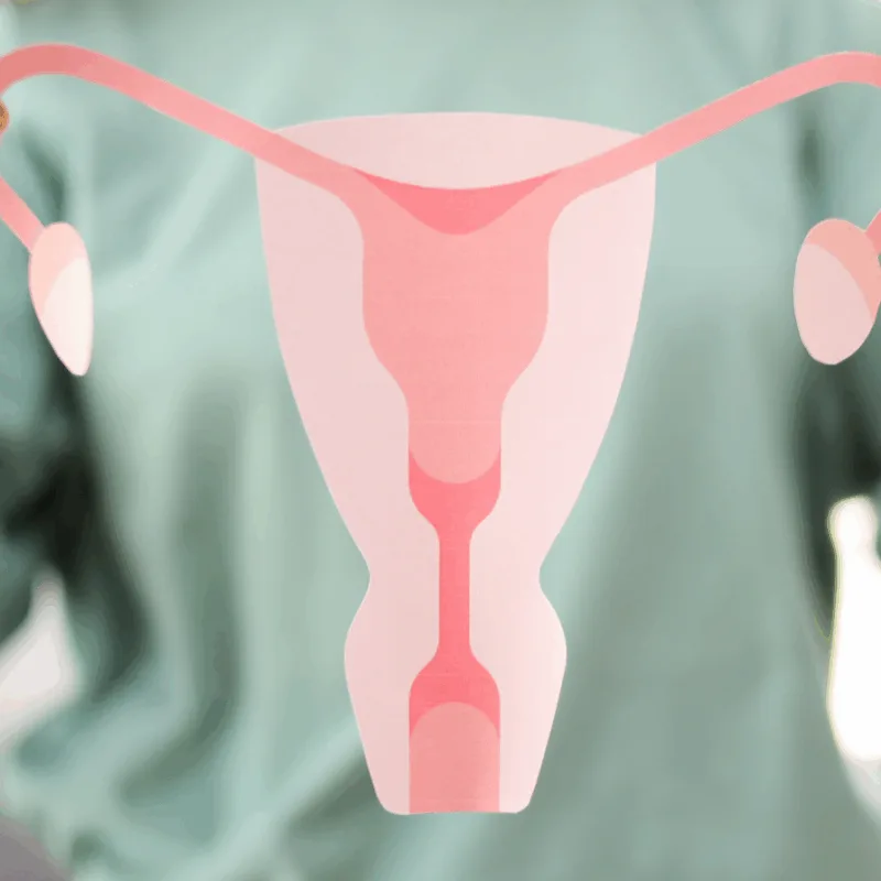 webinaire endométriose